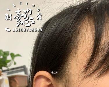 耳洞穿前后都有洞就是穿不进去