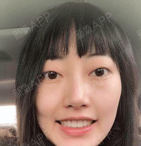 在家自己如何把牙齿弄整齐