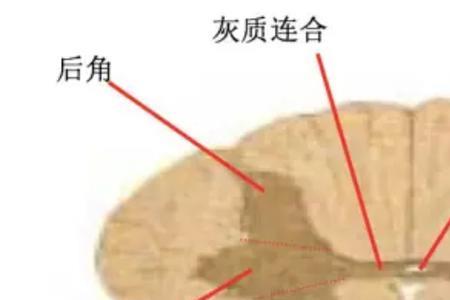 纤维束和白质的区别
