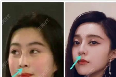 女生的鼻孔像什么