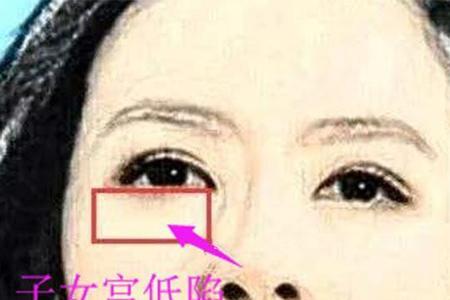 不利子嗣或无子嗣是什么意思