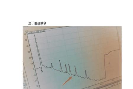 离子色谱出现双头峰的原因