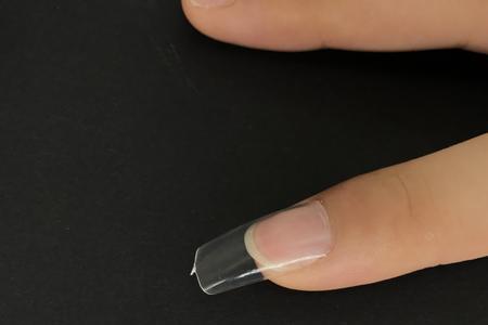 贴甲片里面有水蒸气怎么解决