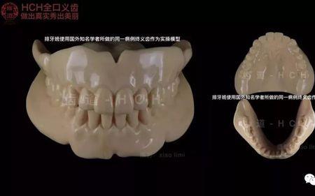 义齿排牙学徒怎么样