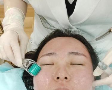 纳晶和微针的区别