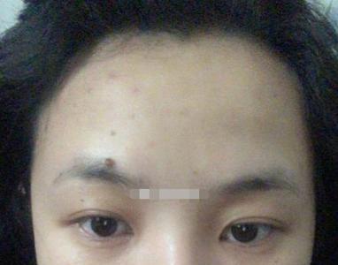 嘴唇厚者不善辞令是什么意思