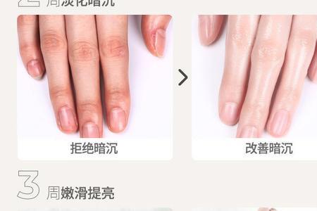 玻尿酸护手精华液几岁可以用