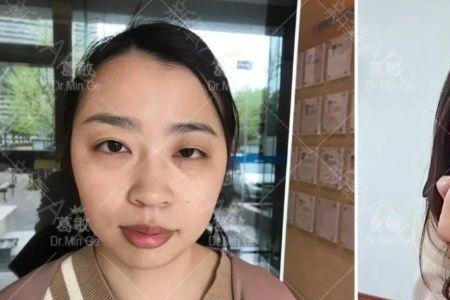 为什么手机拍人眼是歪的