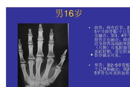 骨龄13岁半的男孩正常身高