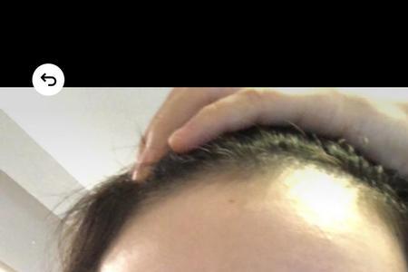 纹眉一边平一边挑可以补救吗