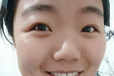 为什么有些人的酒窝不明显
