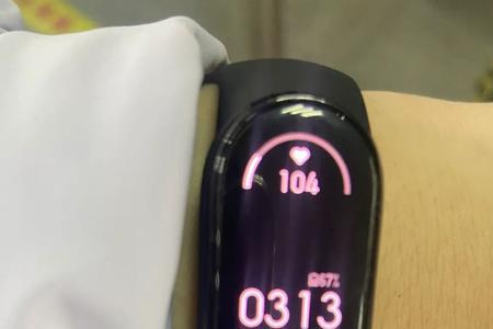 小米手环提示心搏异常