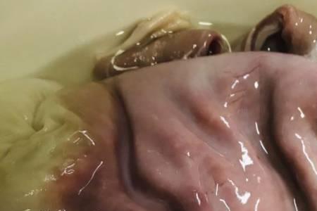 猪肚里的肥油能不能吃