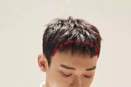 为什么男生两边发际线不一样