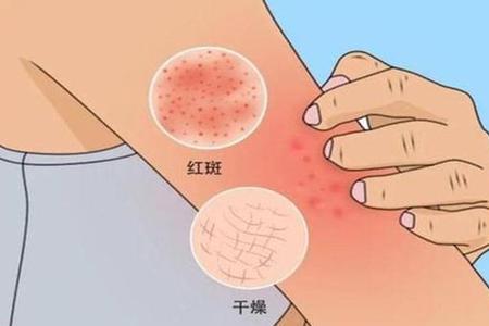 什么是石阵