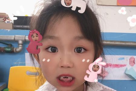 一年级小孩在学校掉牙怎么办