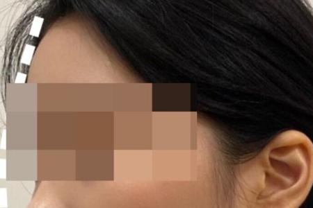 为什么有的人的下巴分两半
