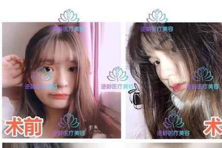 嘟嘟唇女生性格