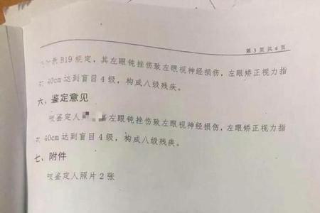 司法鉴定意见书有什么用