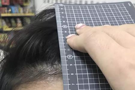 英年早秃是什么意思