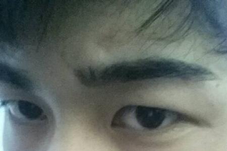 长痘坑的男生为啥都帅