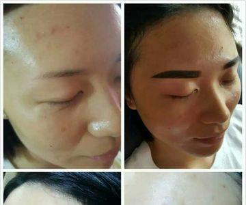 眉毛补色不结痂怎么回事
