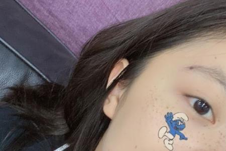 别人说你有痣你怎么怼
