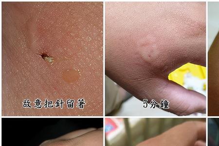 为什么蜜蜂蛰完人要用皂洗
