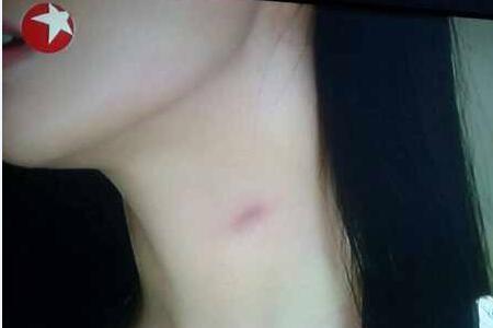 女人吻男人脸全是吻痕