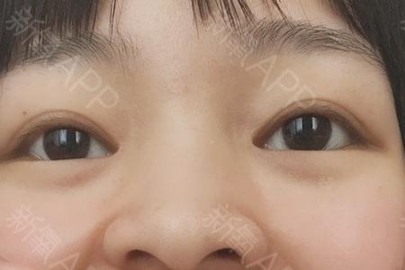 26号牙是哪一颗