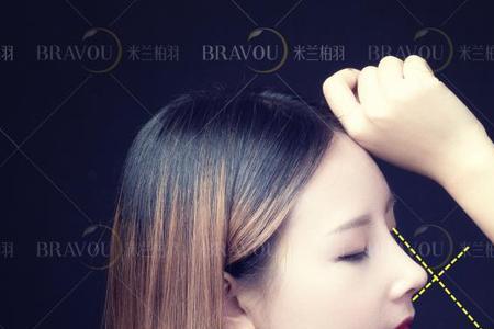 妈生鼻和微翘鼻哪个受欢迎