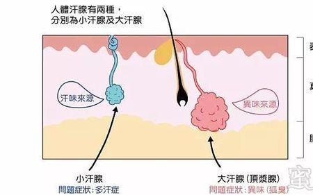 为什么房间一股狐臭味