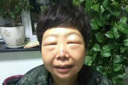 为何蜜蜂喜欢蛰人脸部