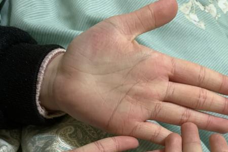 14岁的人手指一般多长