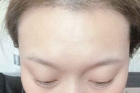 洗头发要洗发际线吗
