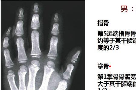 医院测骨龄需要什么证件