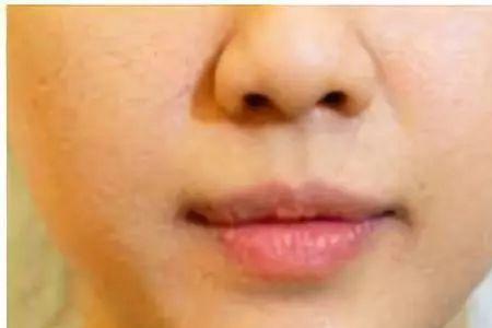 下巴兜和不兜有什么区别