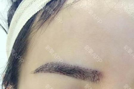 做完眉毛可以吹风不