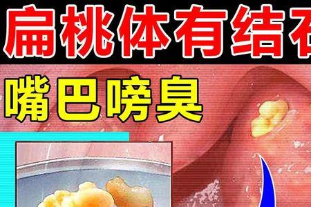 同哝音的字