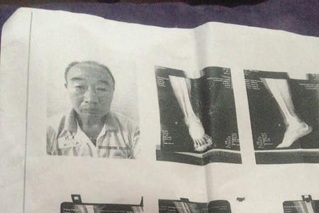 伤残鉴定电子影像拷贝是什么