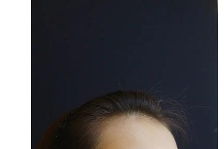 蒙娜丽莎玻尿酸能保持多久