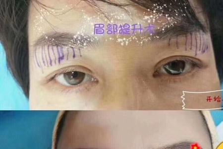 眉毛做过提眉了怎么上色快