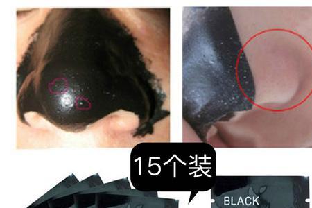 去黑头鼻贴哪个牌子效果最好