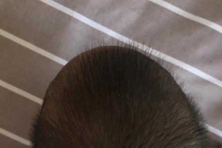 男生戴帽子头发被压扁怎么恢复
