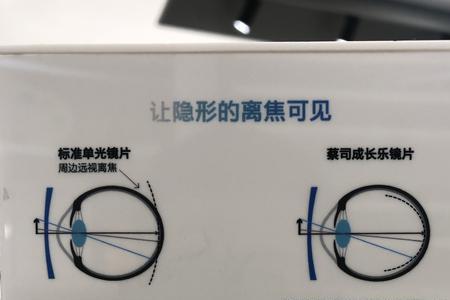 小孩矫正视力万新和蔡司区别