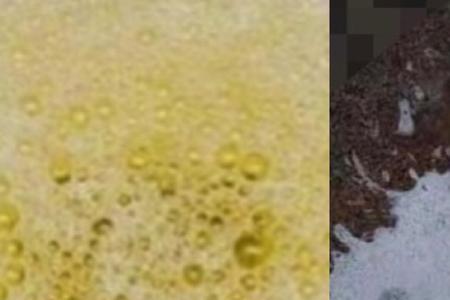 尿到瓶子里摇晃有泡沫不散