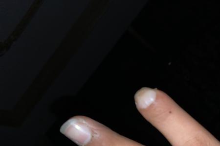 三个手指头多少厘米
