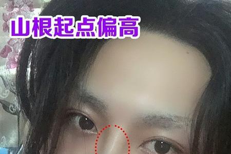 男孩子的鼻梁是不是比女孩的高