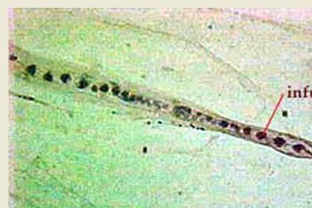 中体是什么生物