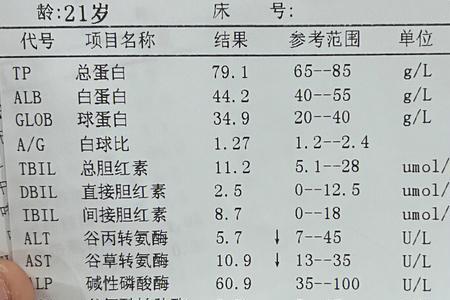 公务员尿检有人跟着看吗